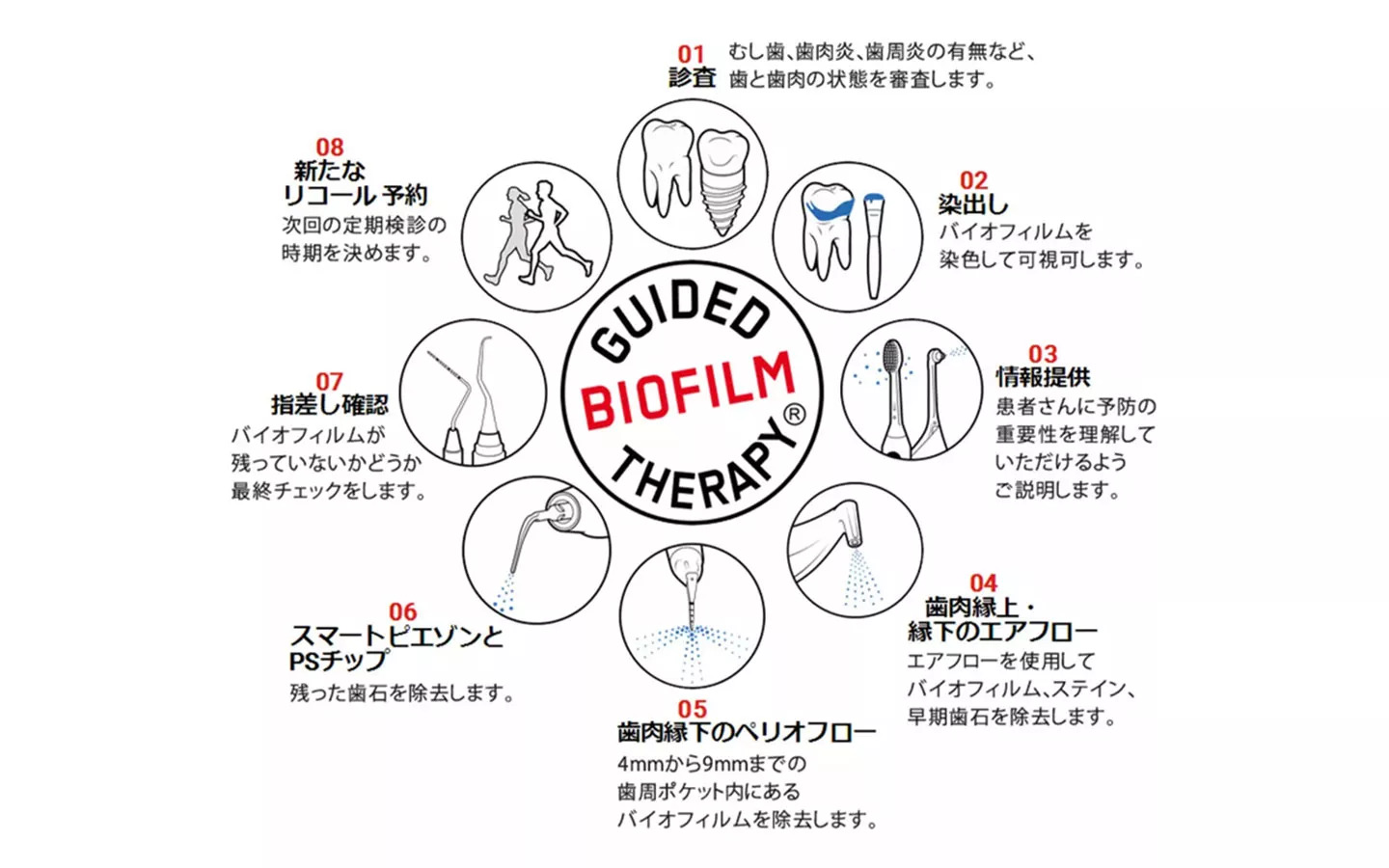 GBTによる歯周病予防処置